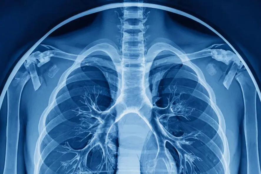Russian Scientists Develop AI Module for Lung Surgery Planning