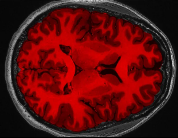 Russian Scientists Create Software for 3D Brain Modeling