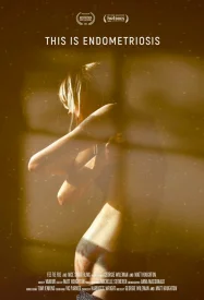 Это эндометриоз