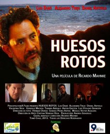 Сломанные кости