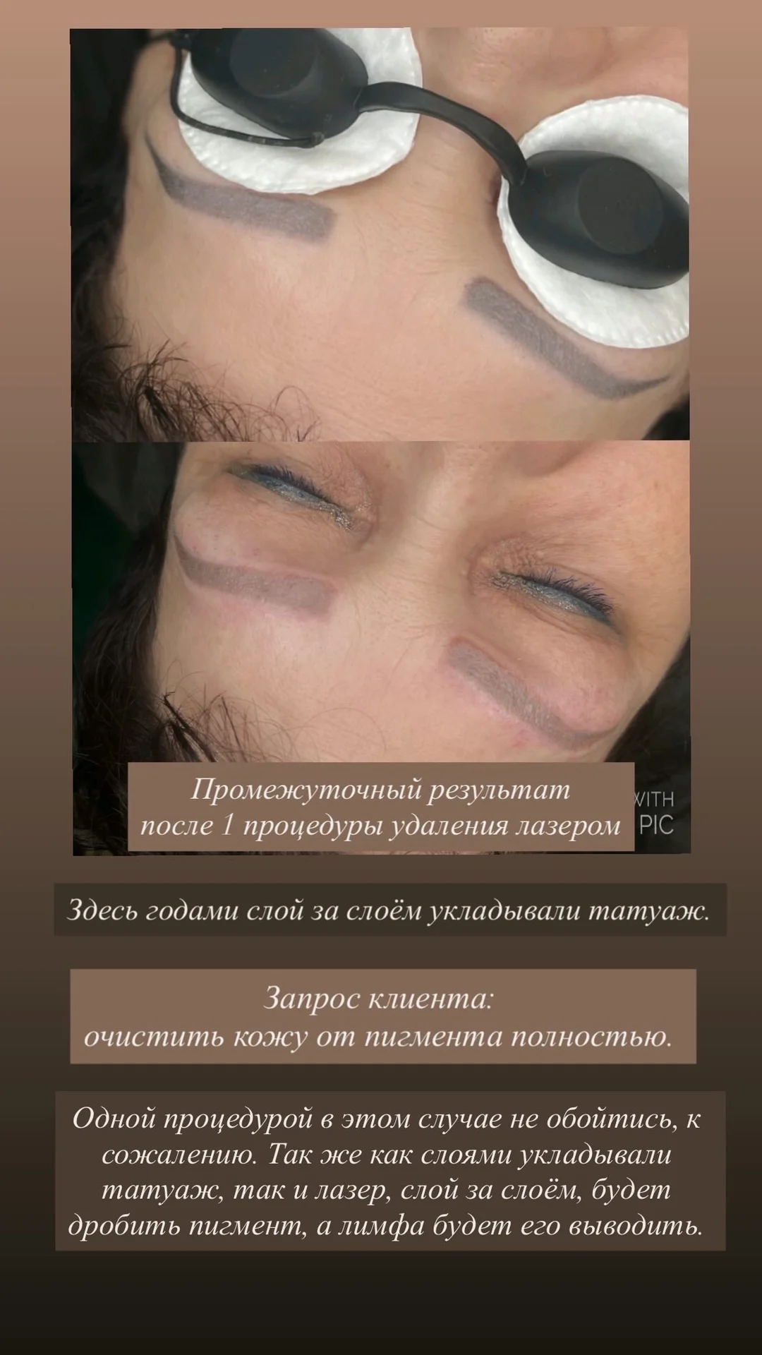 Ламинирование ресниц - миниатюра 8