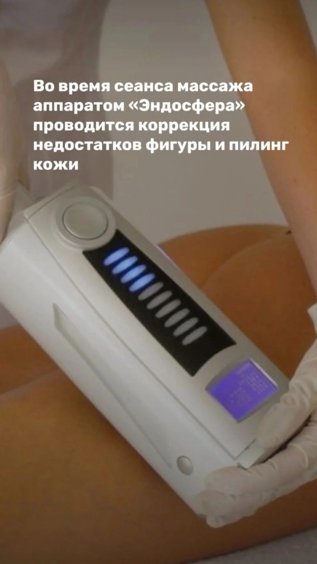 Коррекция фигуры Сфера - миниатюра 3