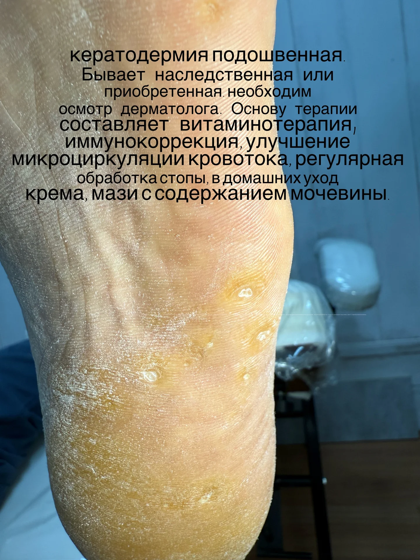 Маникюр, педикюр, подолог - миниатюра 12