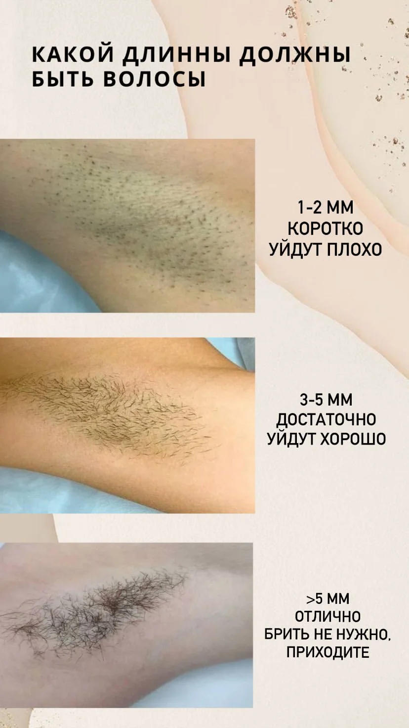 Шугаринг мужской и женский - миниатюра 2