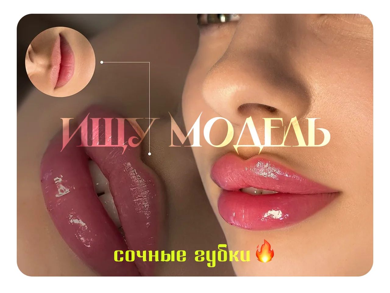 Модель на Увеличение губ Натуральный эффект - изображение 1