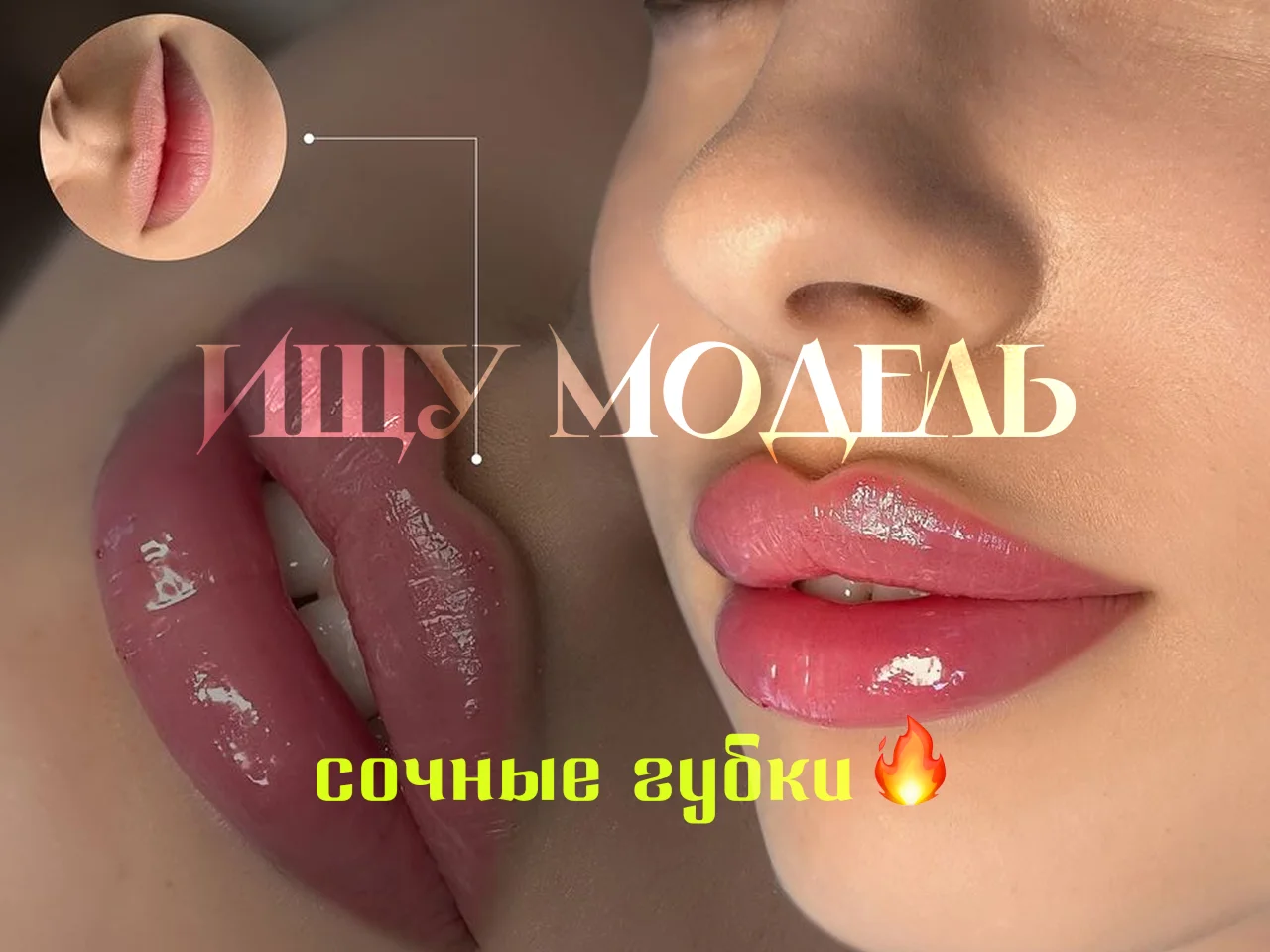 Модель на Увеличение губ Натуральный эффект - изображение 1