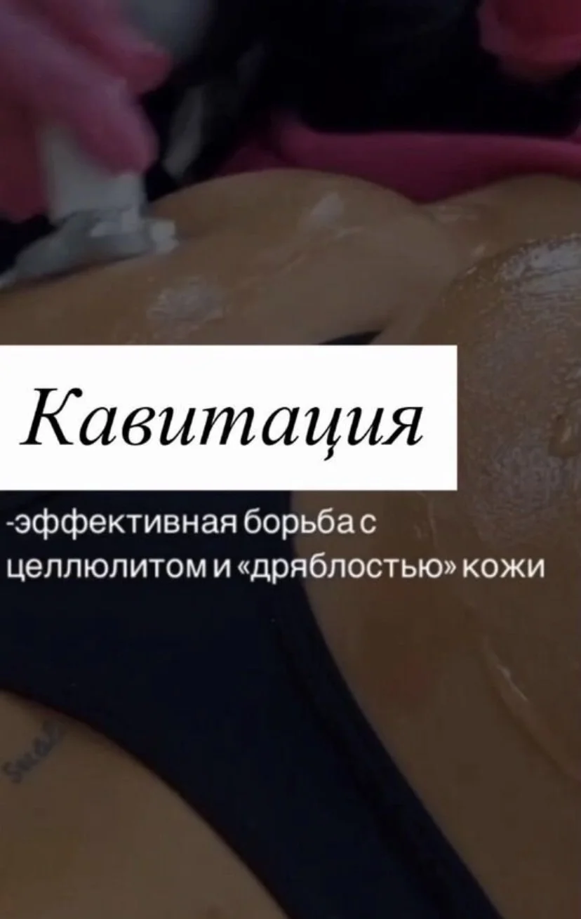 Аппаратная косметология. Пилинги - миниатюра 5