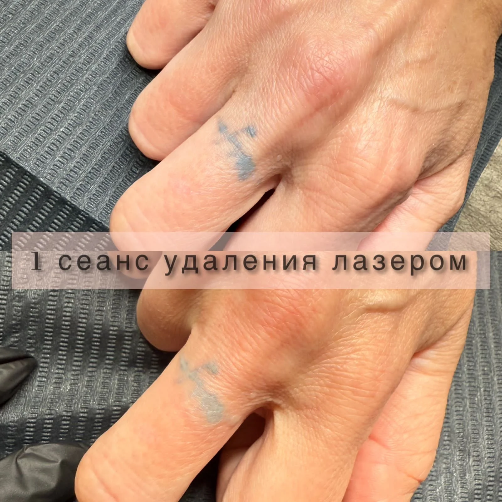Диодный лазер - миниатюра 5