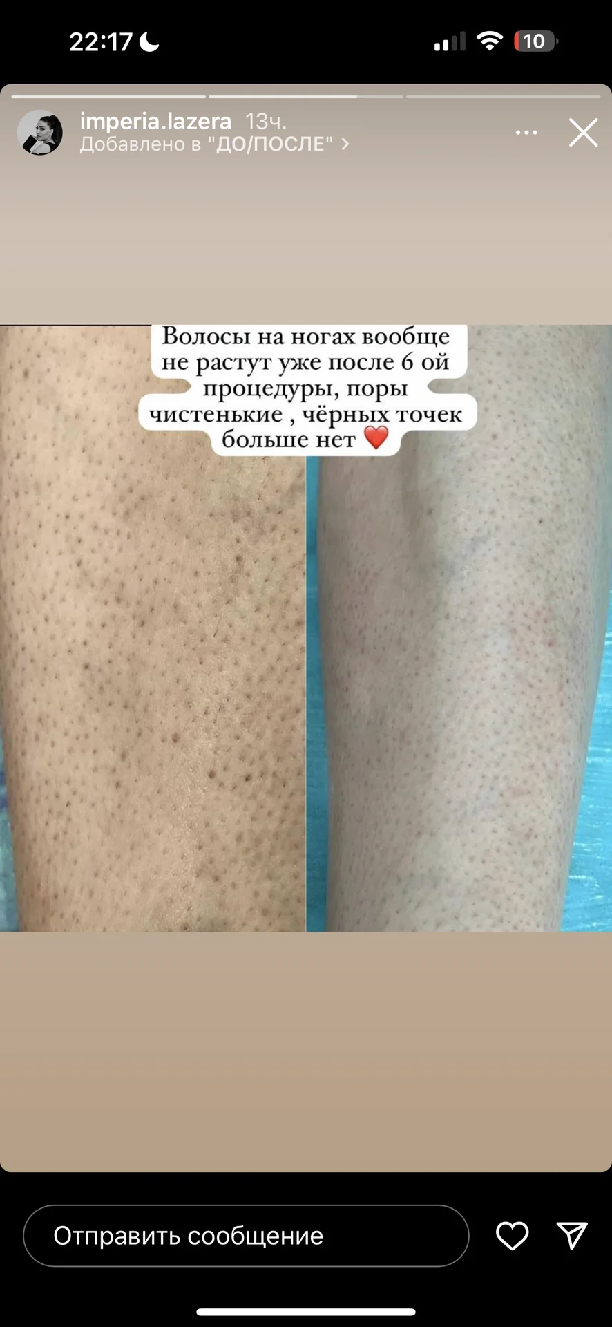 Диодный лазер мощный - миниатюра 3