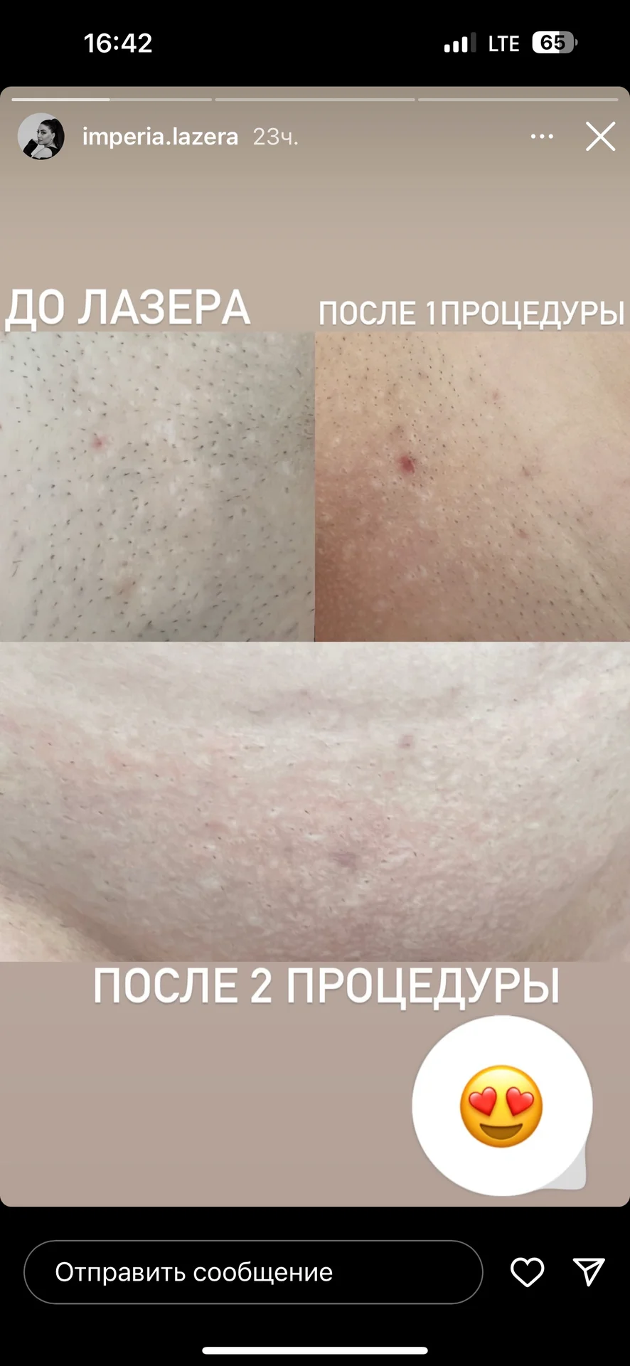 Диодный лазер мощный - миниатюра 4