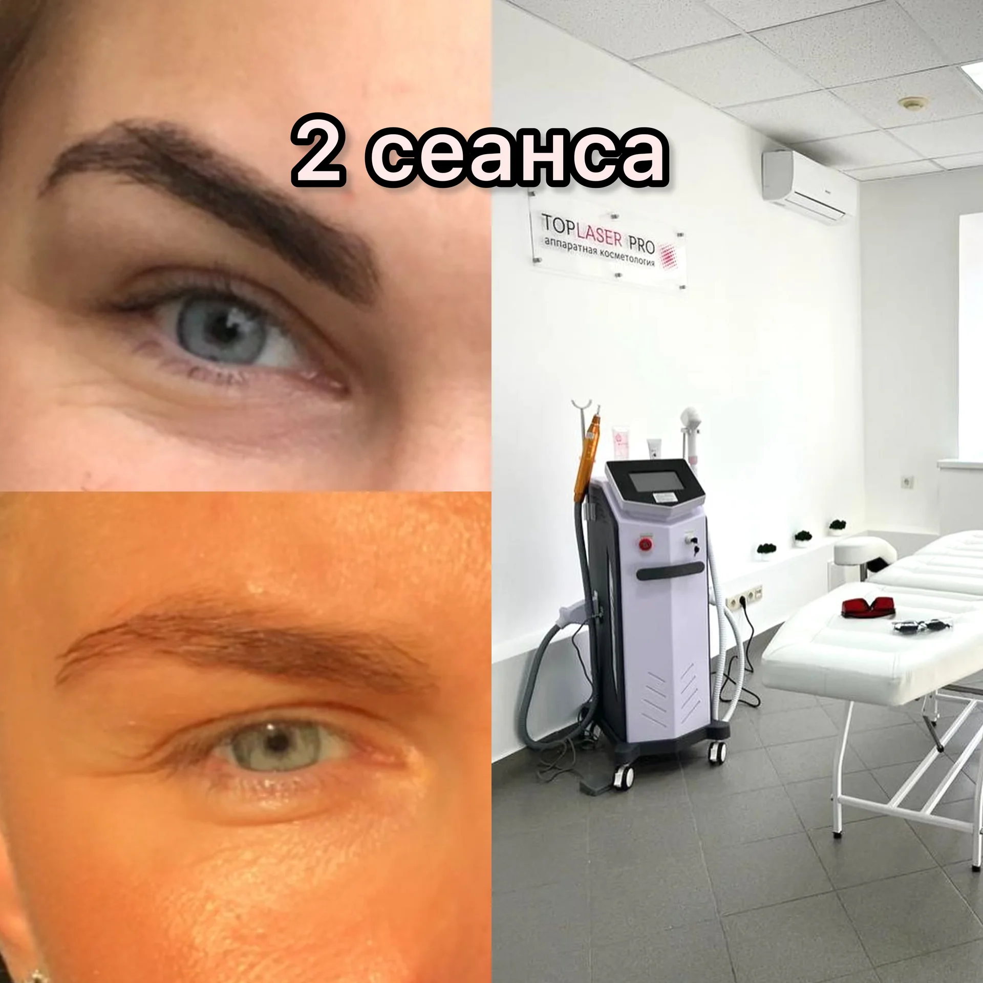 Диодный лазер мощный - миниатюра 7