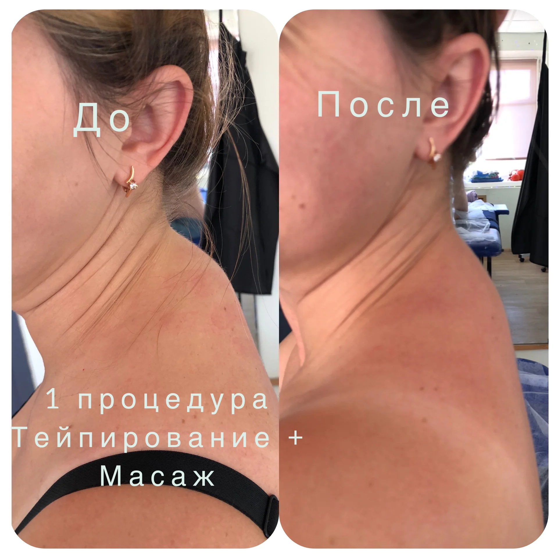 Классический массаж - миниатюра 3