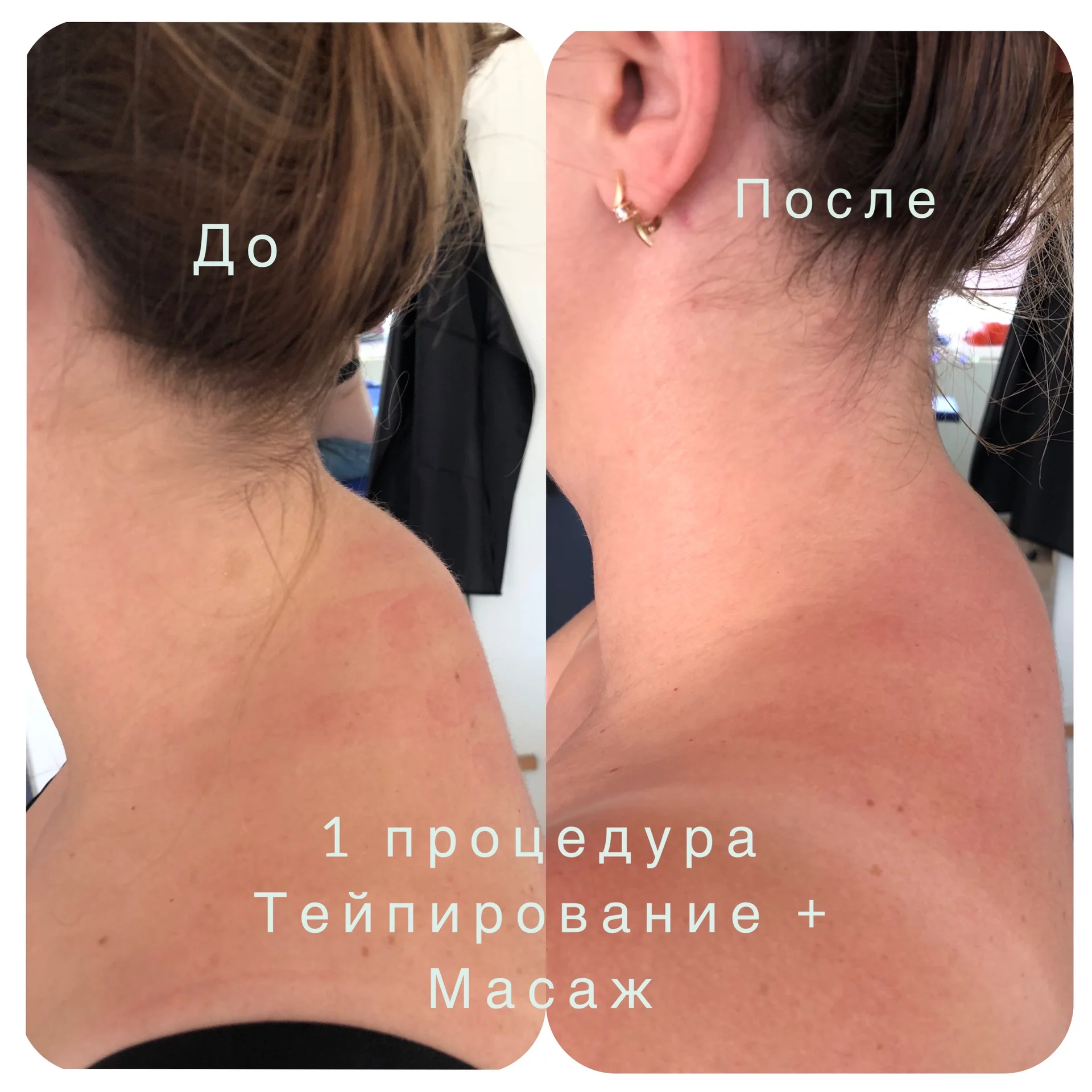 Классический массаж - миниатюра 4