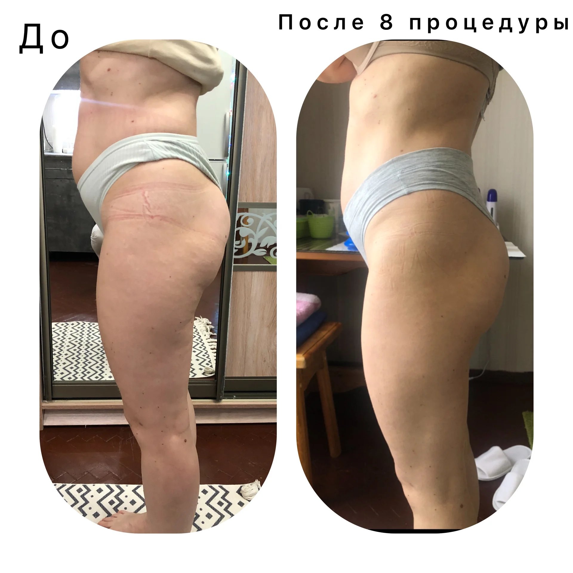 Классический массаж - миниатюра 8