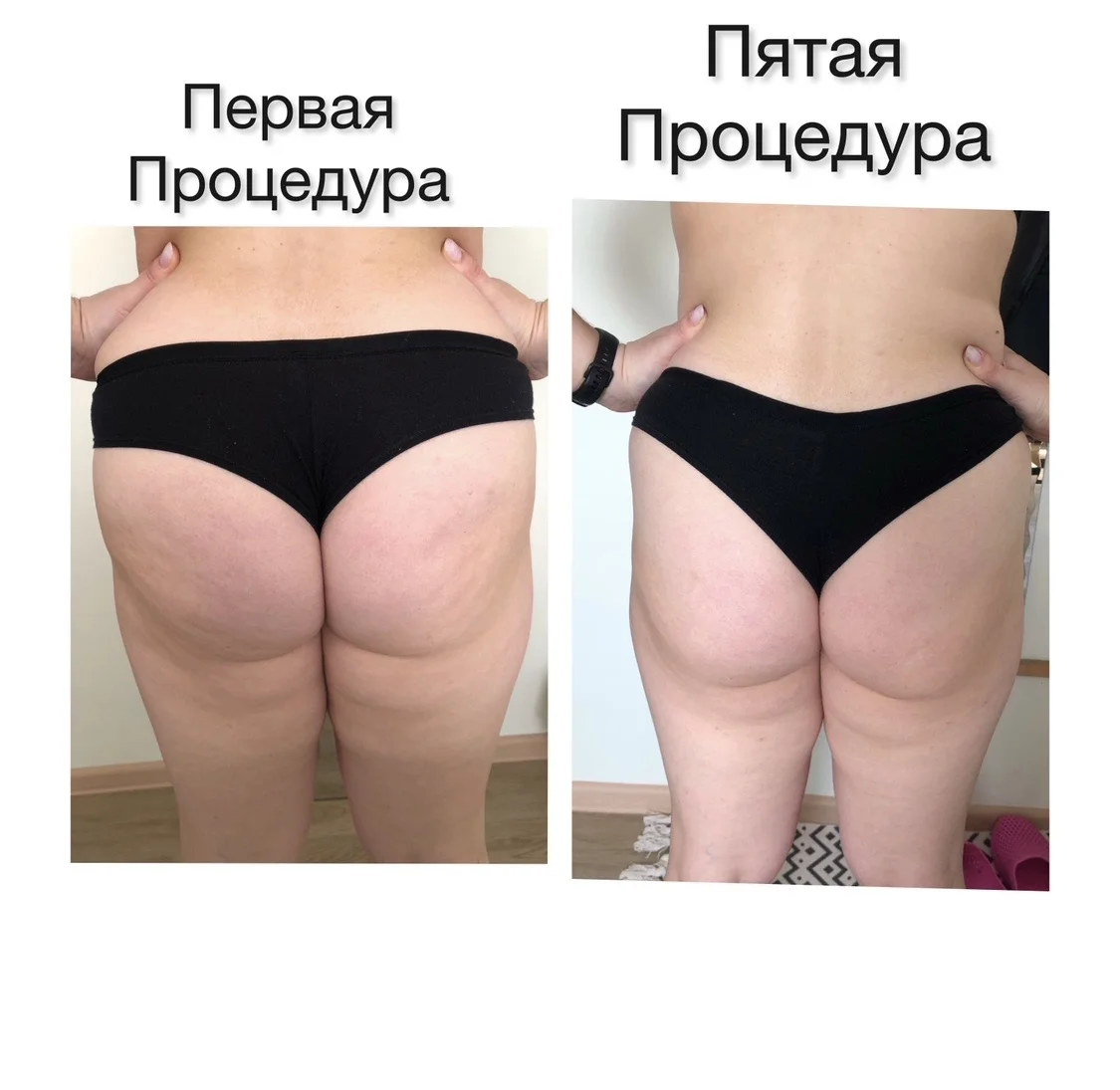 Классический массаж - миниатюра 9