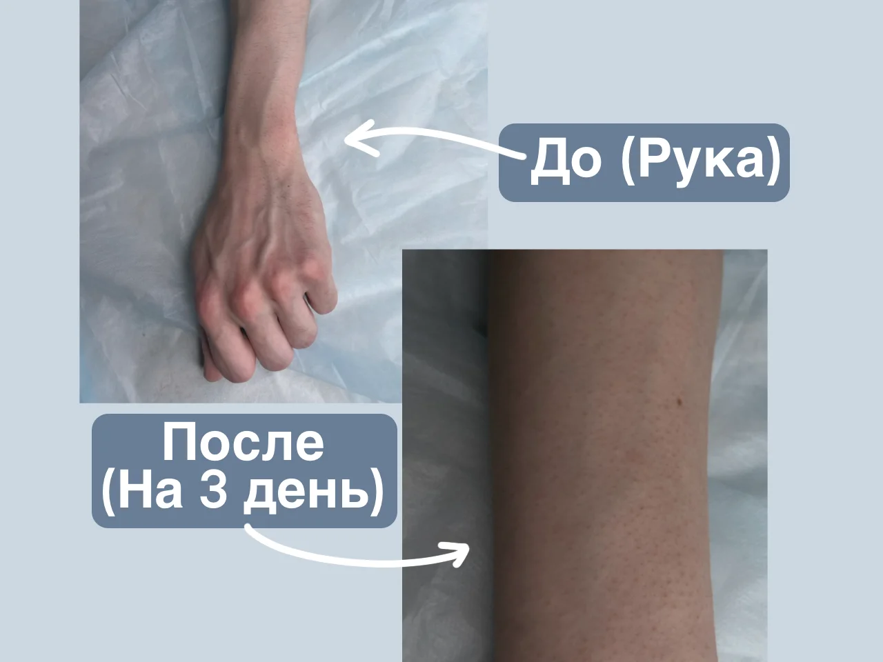 Электроэпиляция модель Малаховка - миниатюра 3