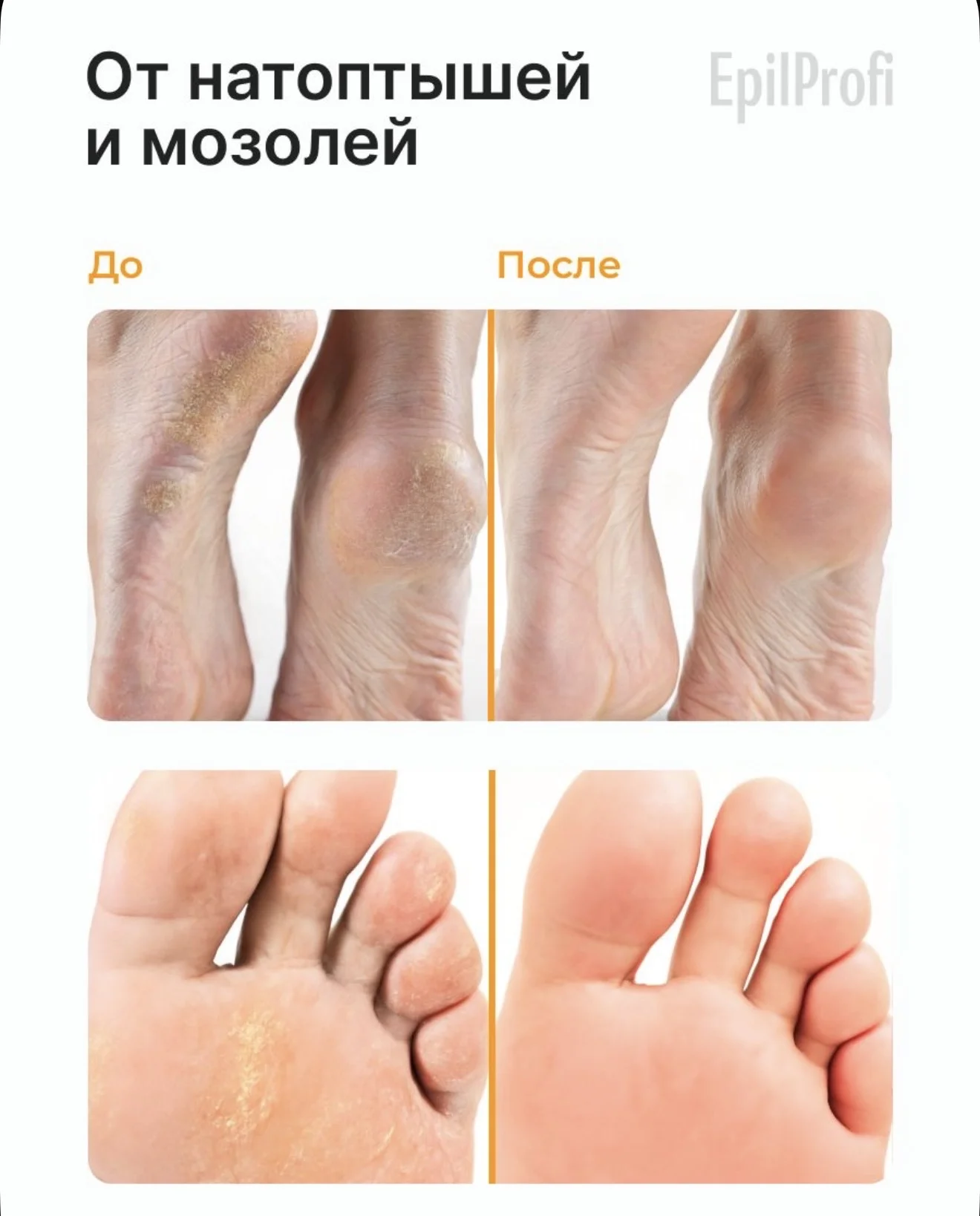 Крем-воск от трещин EpilProfi - миниатюра 2