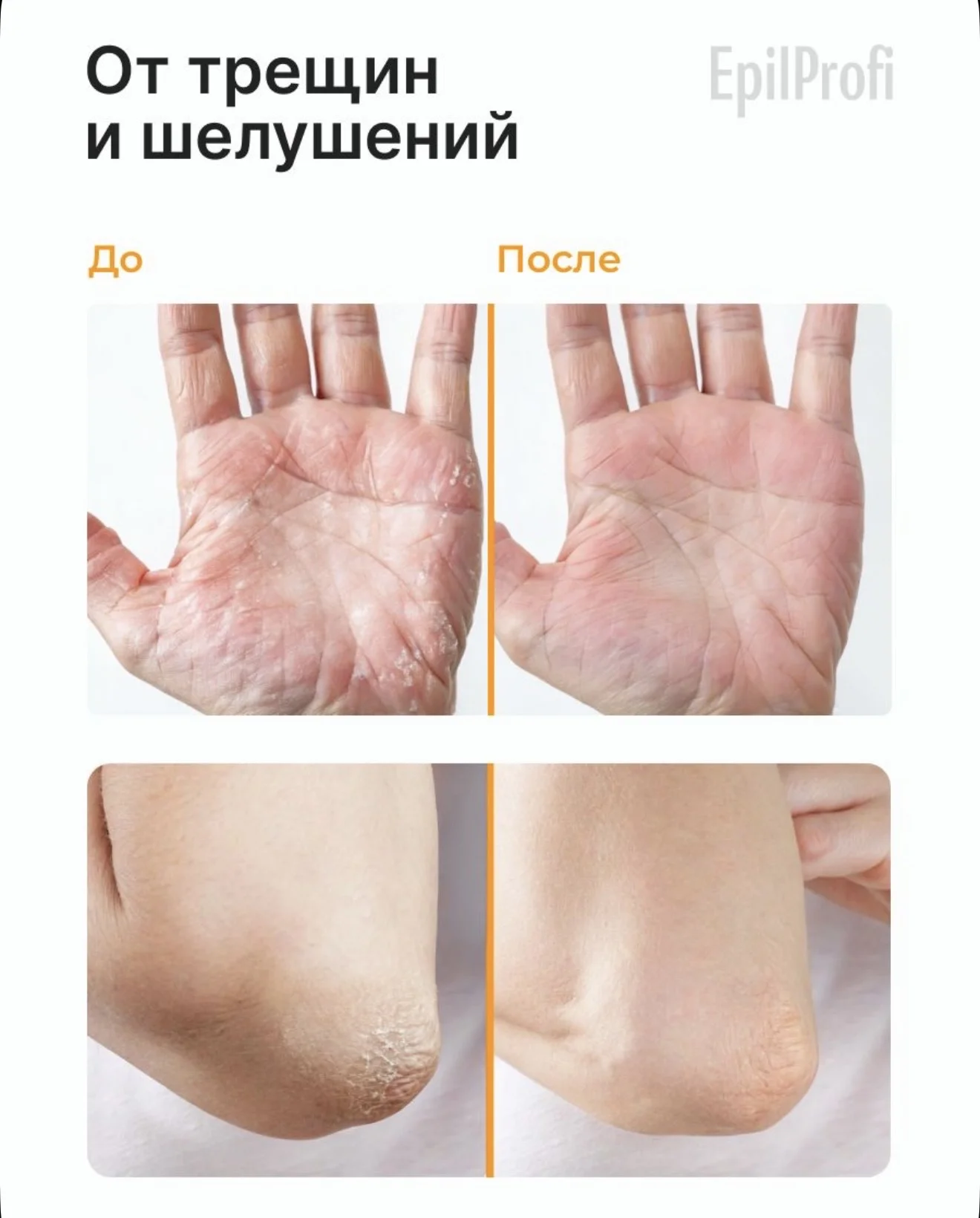 Крем-воск от трещин EpilProfi - миниатюра 3