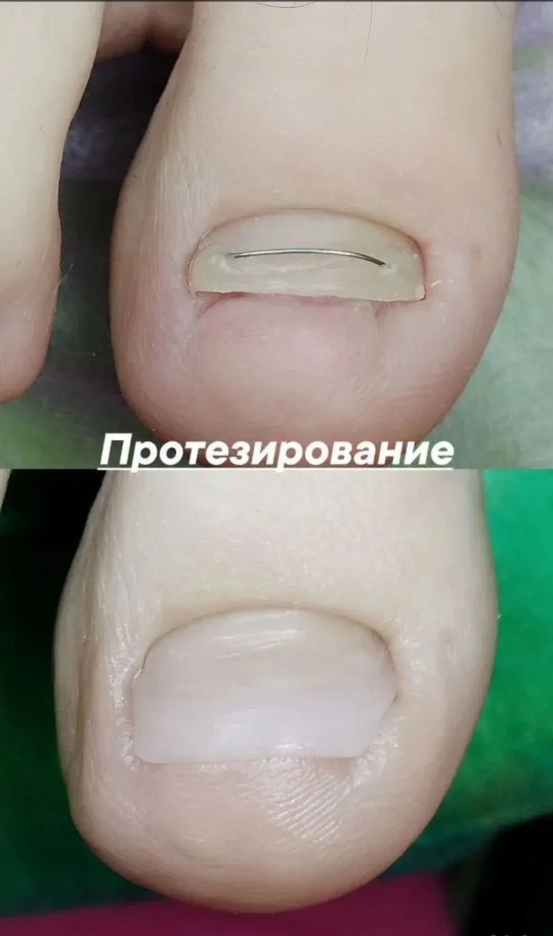 Подолог в кабинете и на дом - миниатюра 5