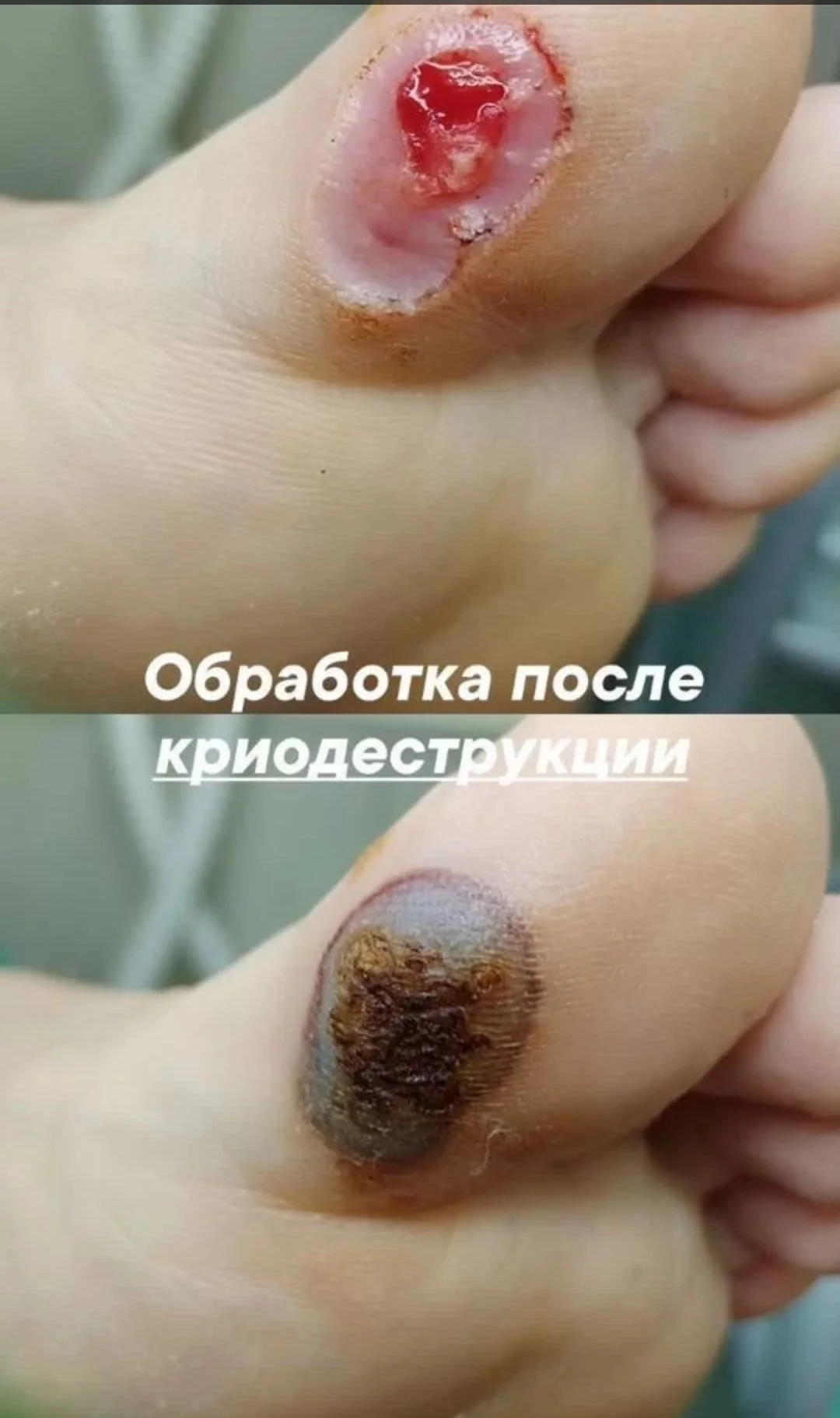 Подолог в кабинете и на дом - миниатюра 8