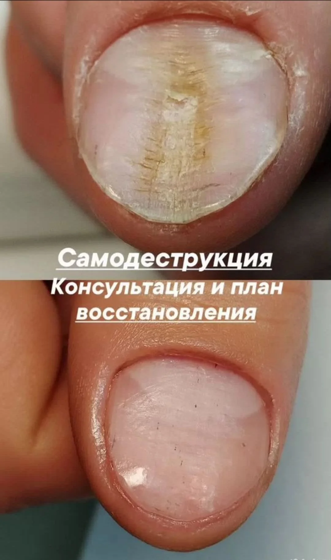 Подолог в кабинете и на дом - миниатюра 10