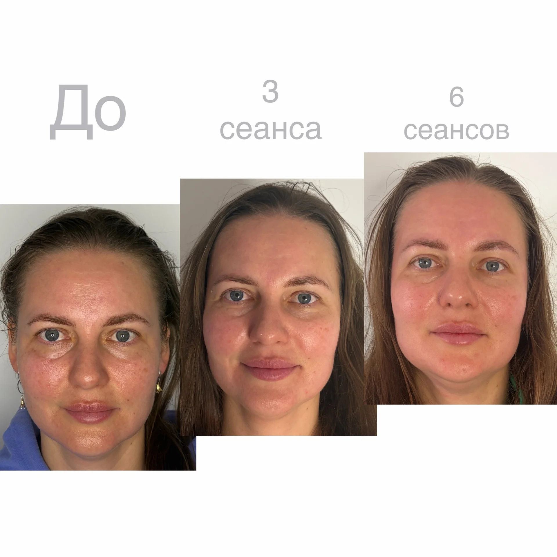 Массаж Сочи - миниатюра 2