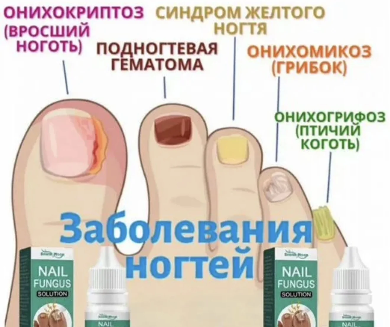 Средство от грибка ногтей - изображение 1