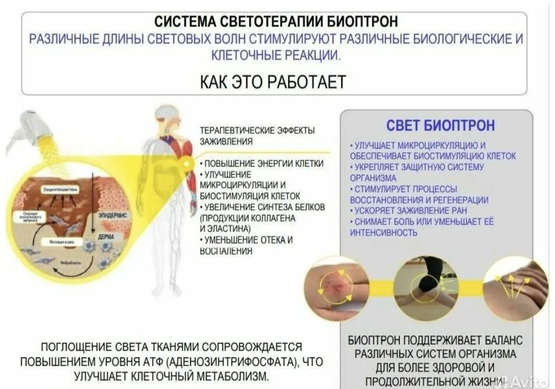 Аренда биоптрона Zepter - миниатюра 2