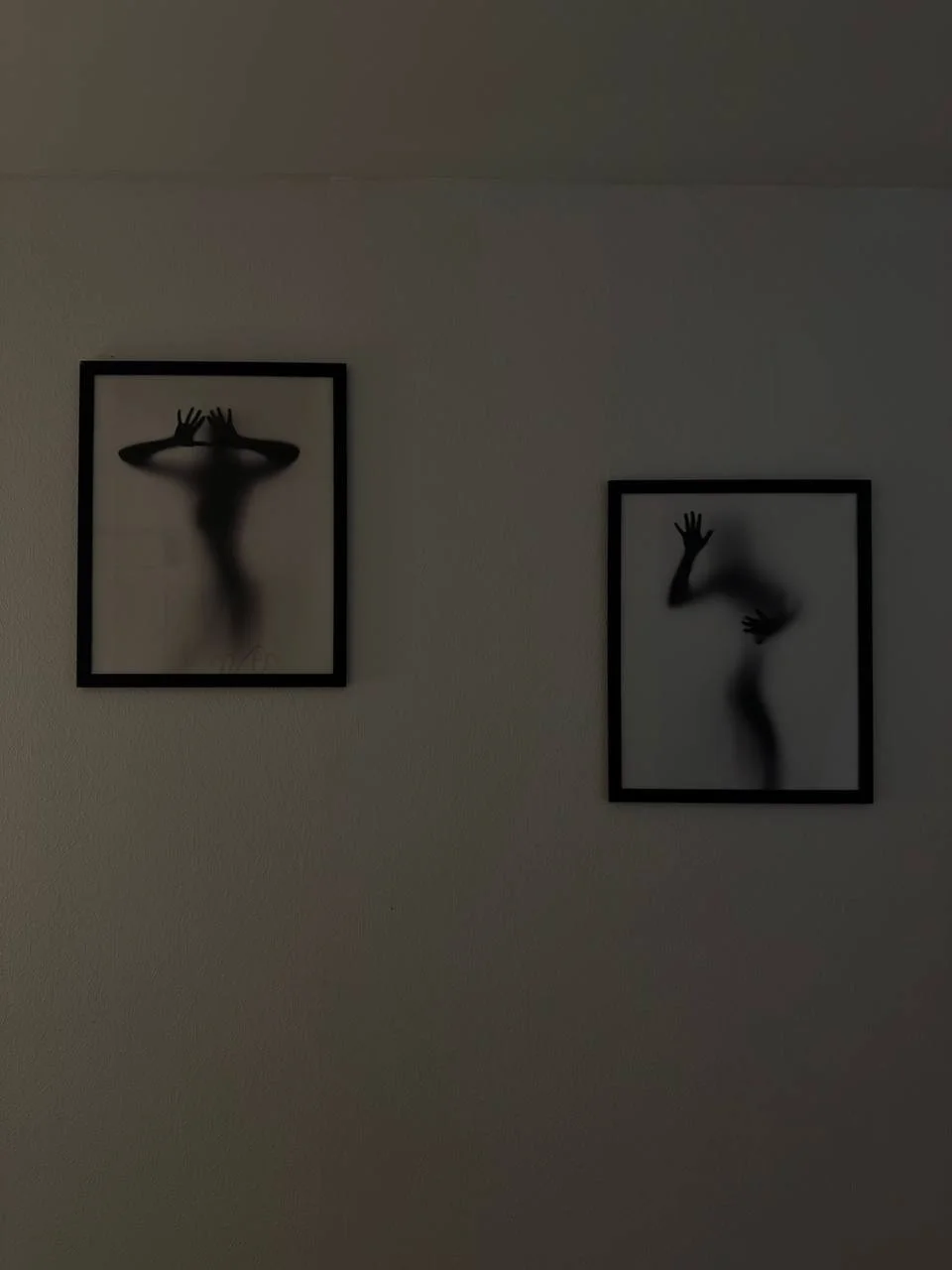 Лазерная эпиляция доя мужчин и женщин🤍 - миниатюра 5