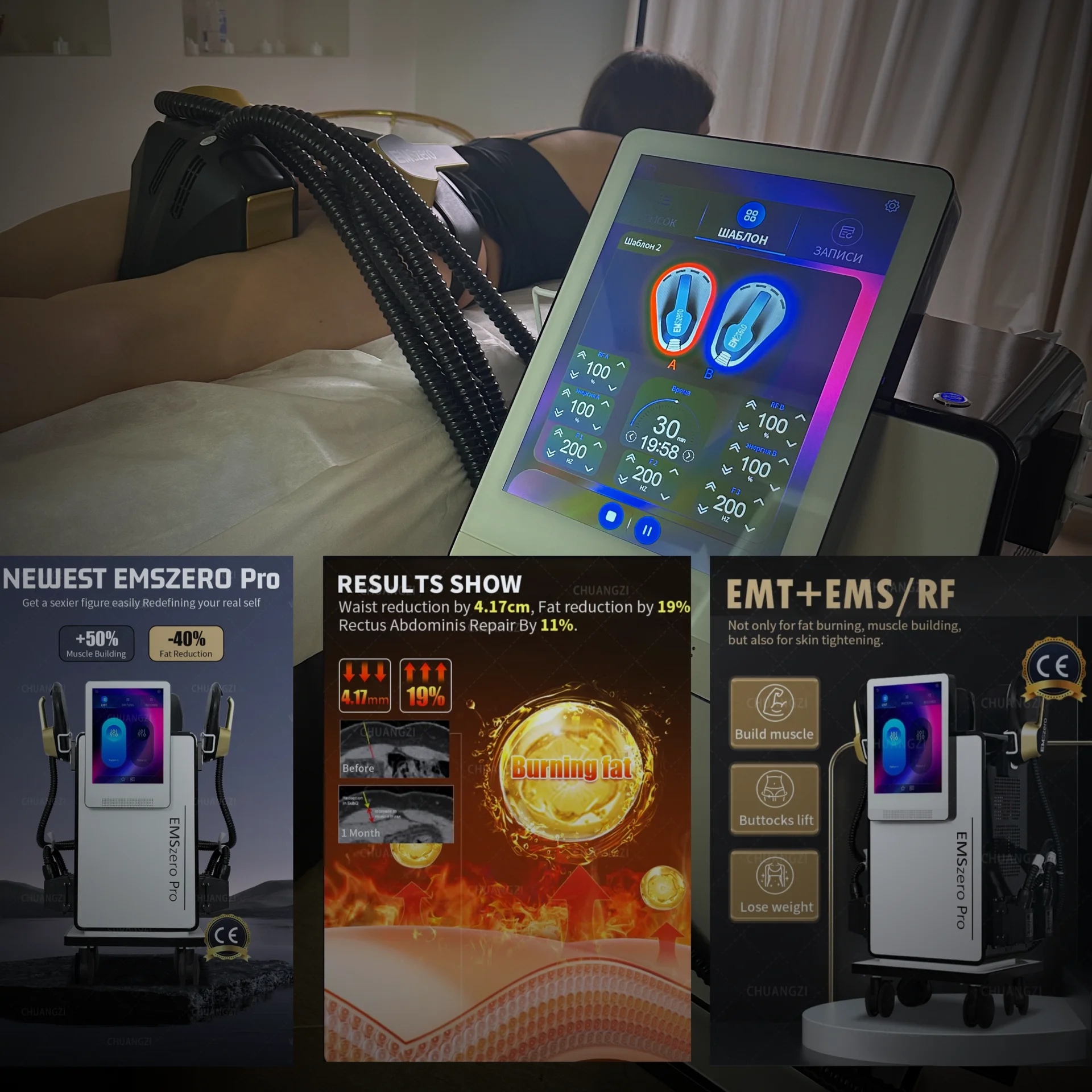 EMS zero Pro аппарат электромагнитной стимуляции м - миниатюра 19