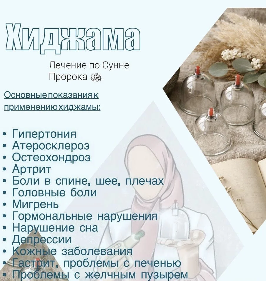Хиджама - изображение 1