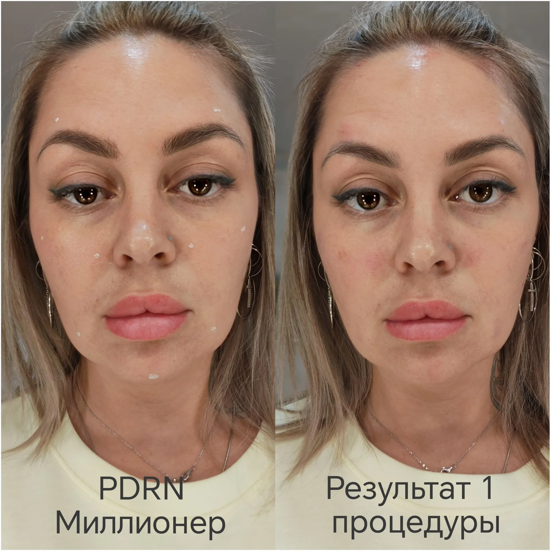 Косметолог - миниатюра 8
