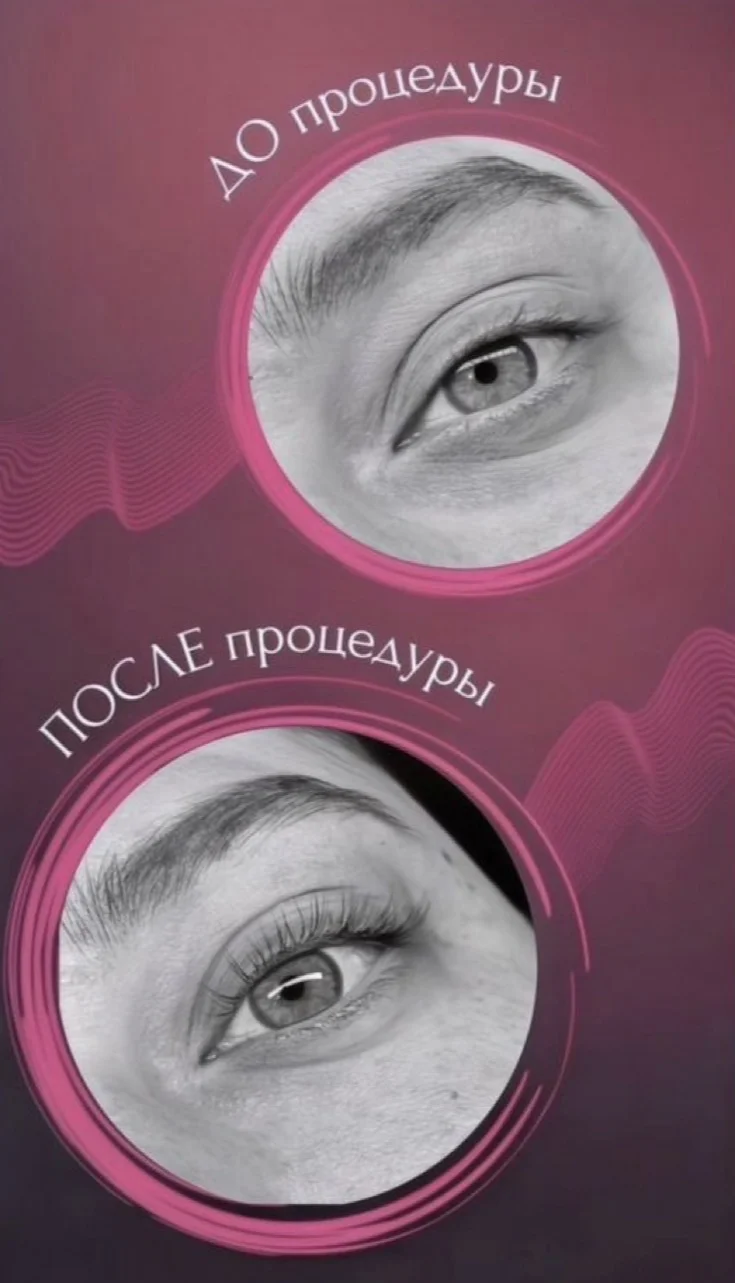 Ламинирование ресниц - миниатюра 2