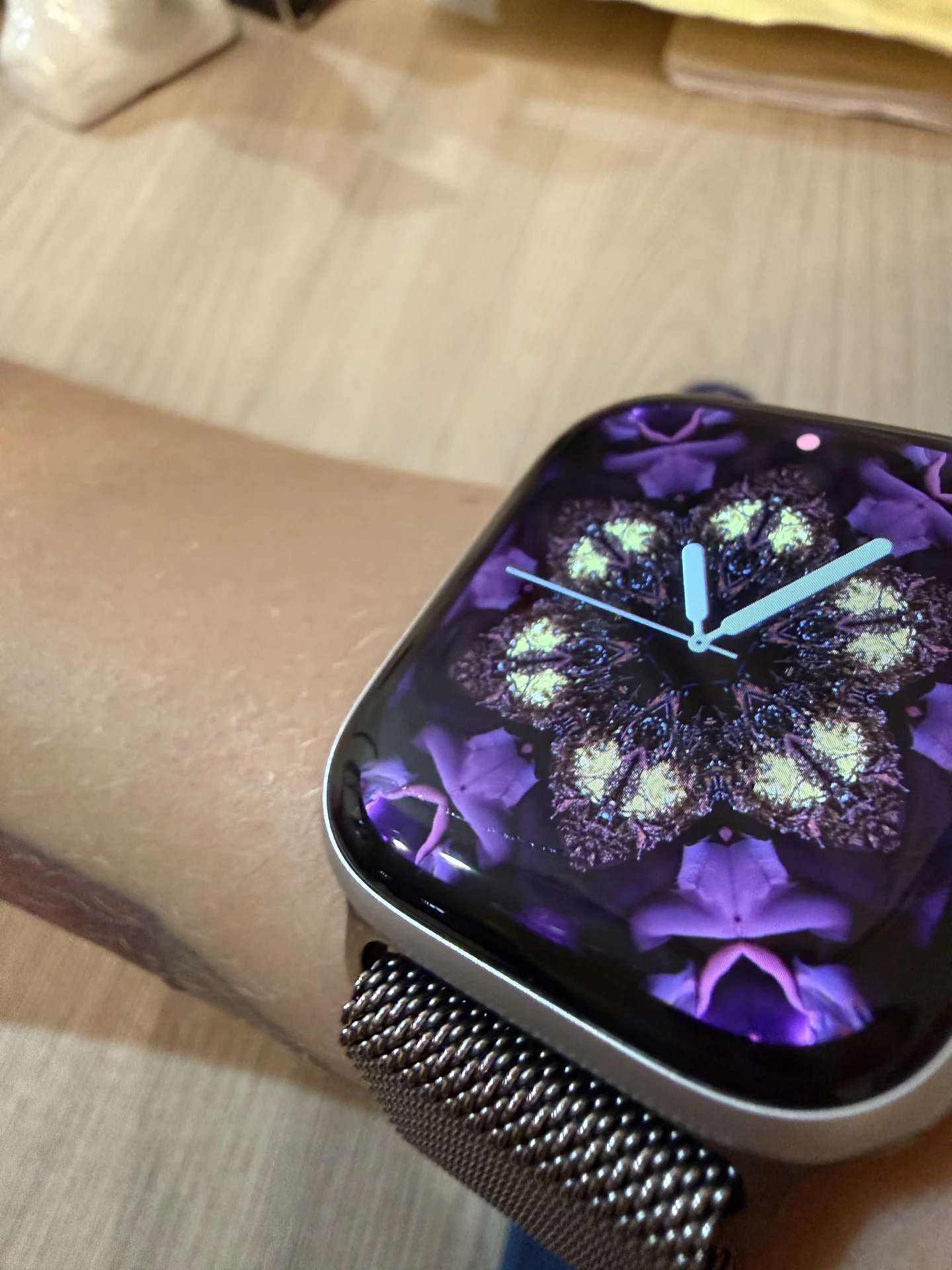 Apple Watch часы и 2 ремешка - миниатюра 2