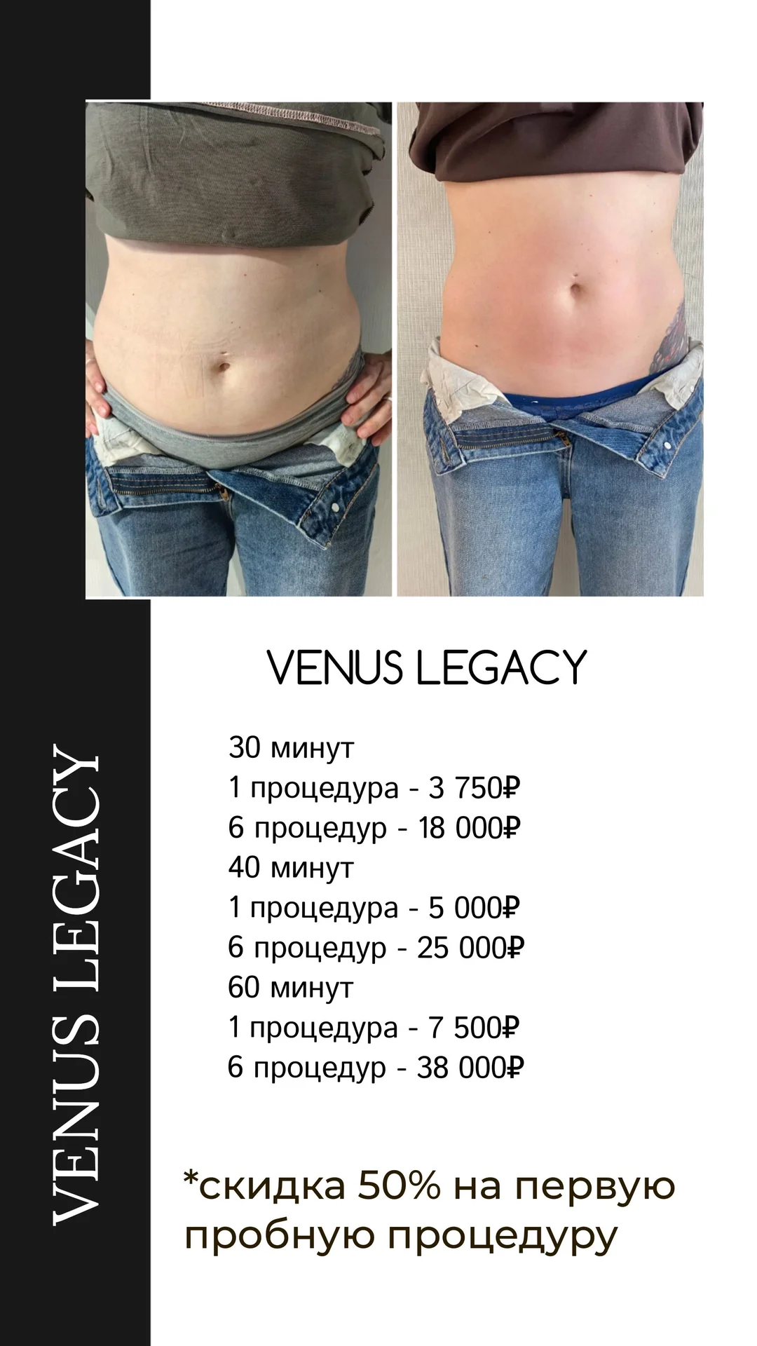 Коррекция фигуры на аппарате VENUS LEGACY - изображение 1