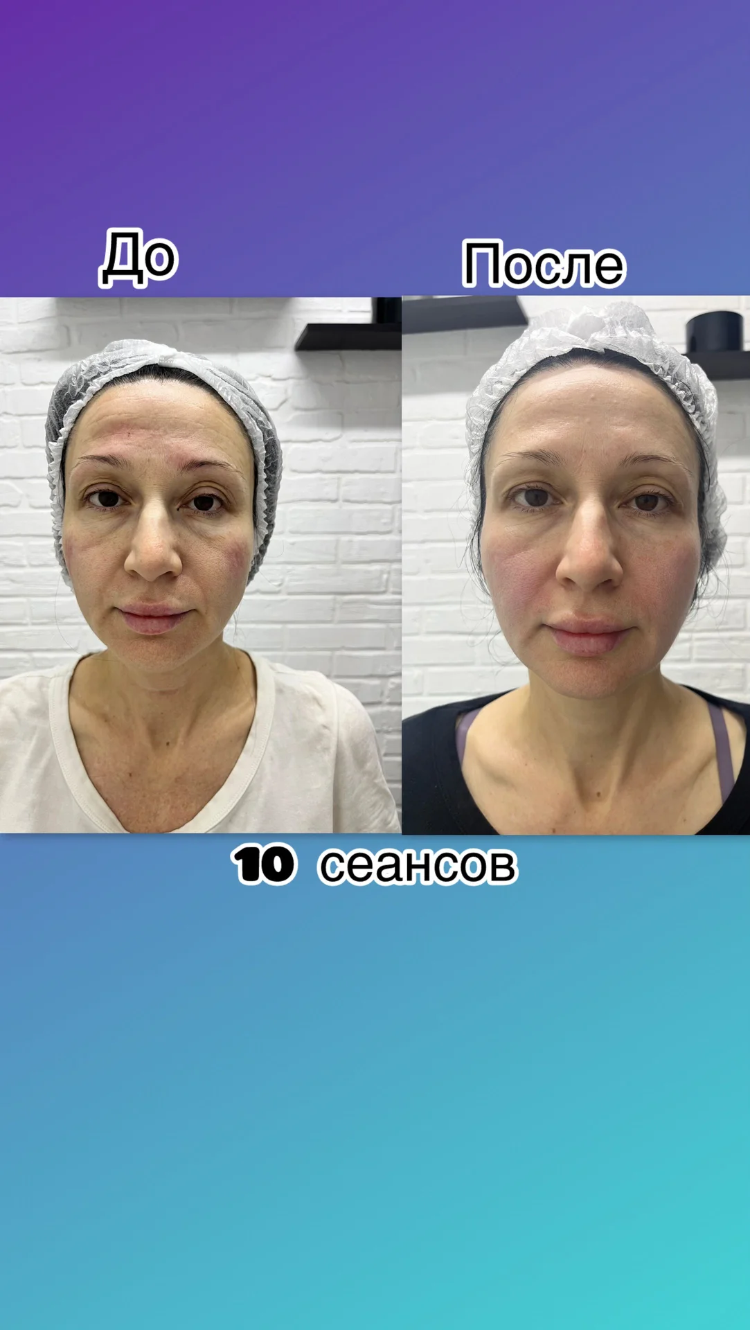 массаж - миниатюра 5