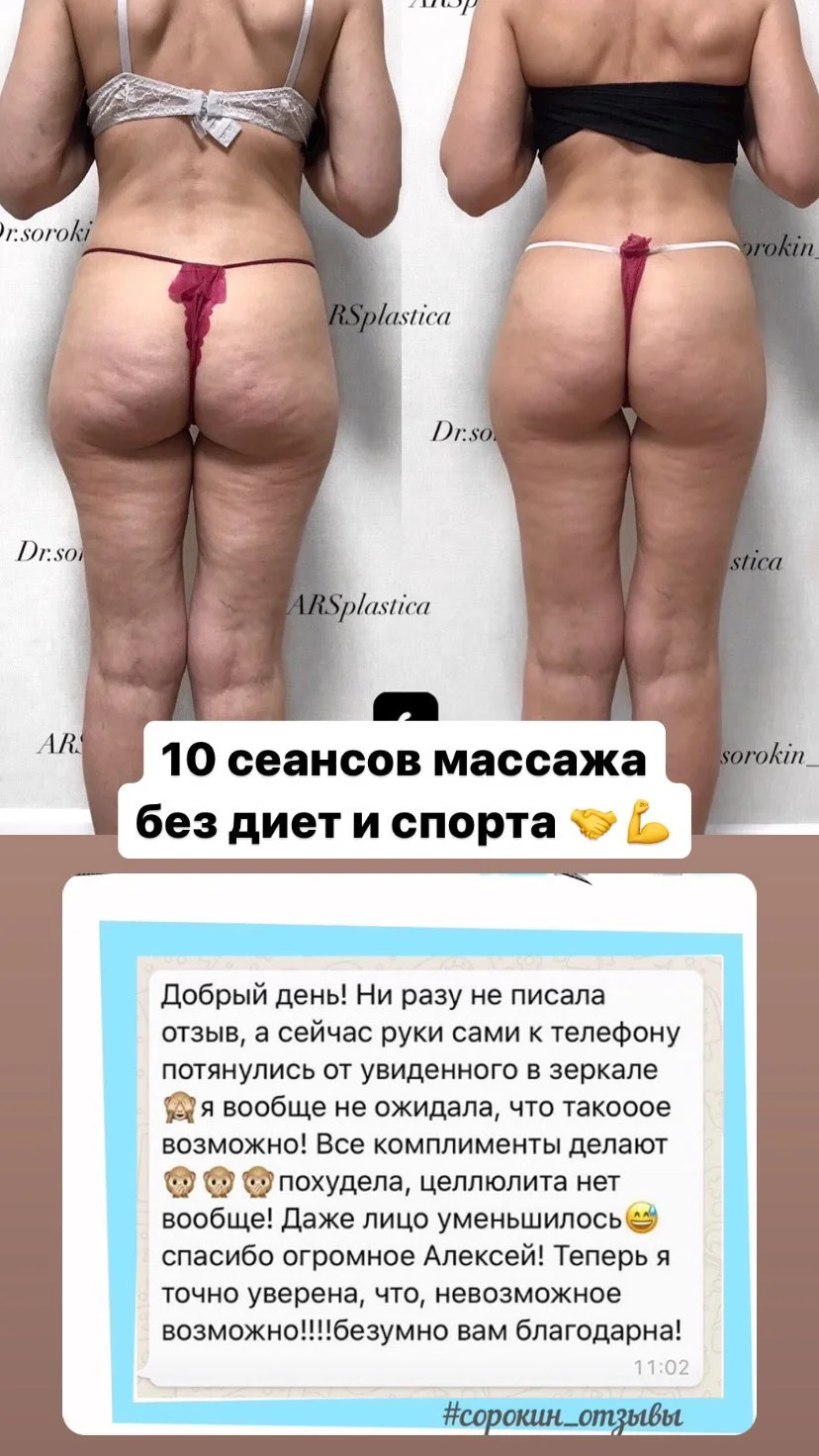 МАССАЖ ДЛЯ КОРРЕКЦИИ ФИГУРЫ И ЗДОРОВЬЯ 🔥 - миниатюра 4