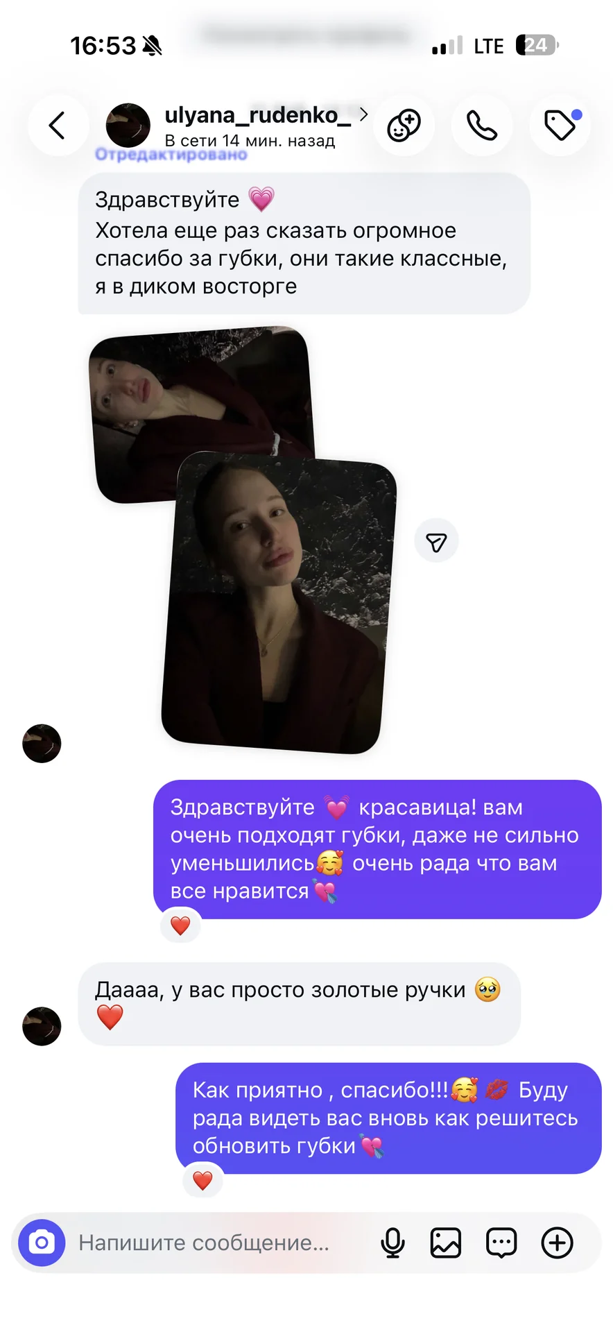 увеличение губ москва. контурная пластика губ. - миниатюра 4