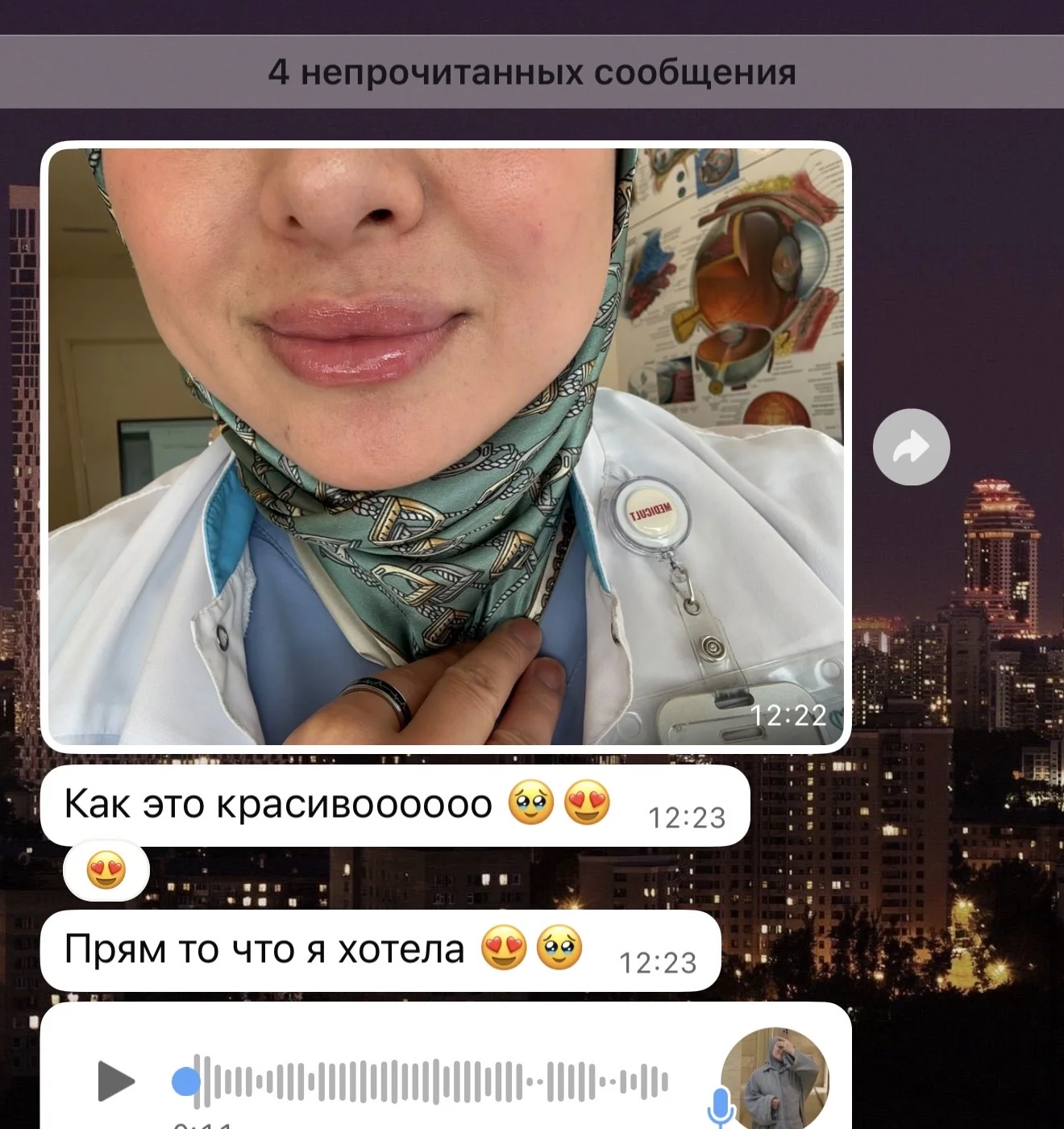 увеличение губ москва. контурная пластика губ. - миниатюра 7