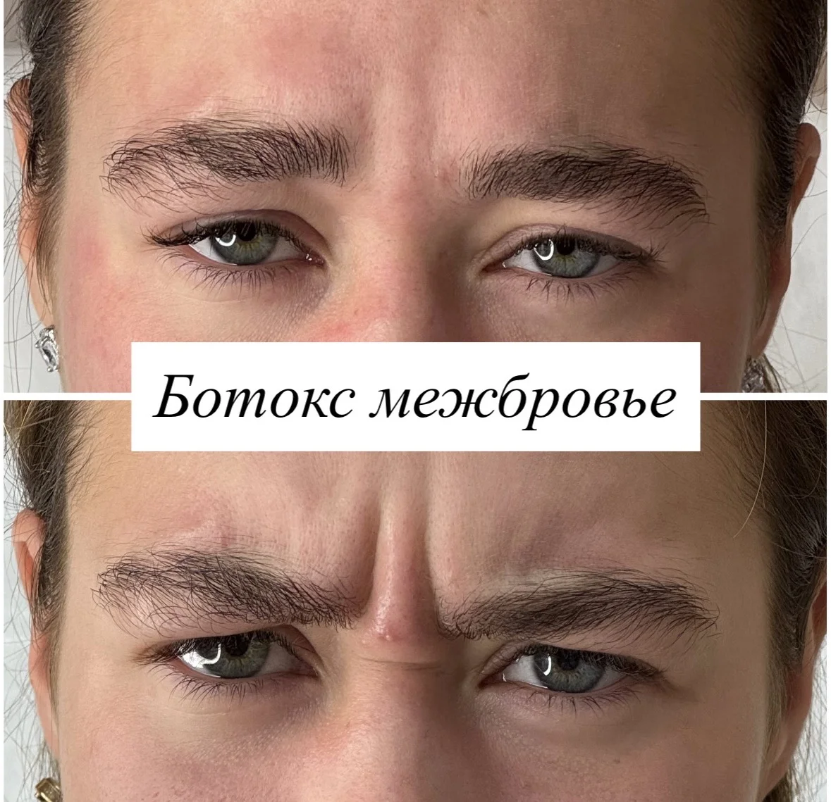Косметолог Мезотерапия липолитики биоревитализация - миниатюра 11