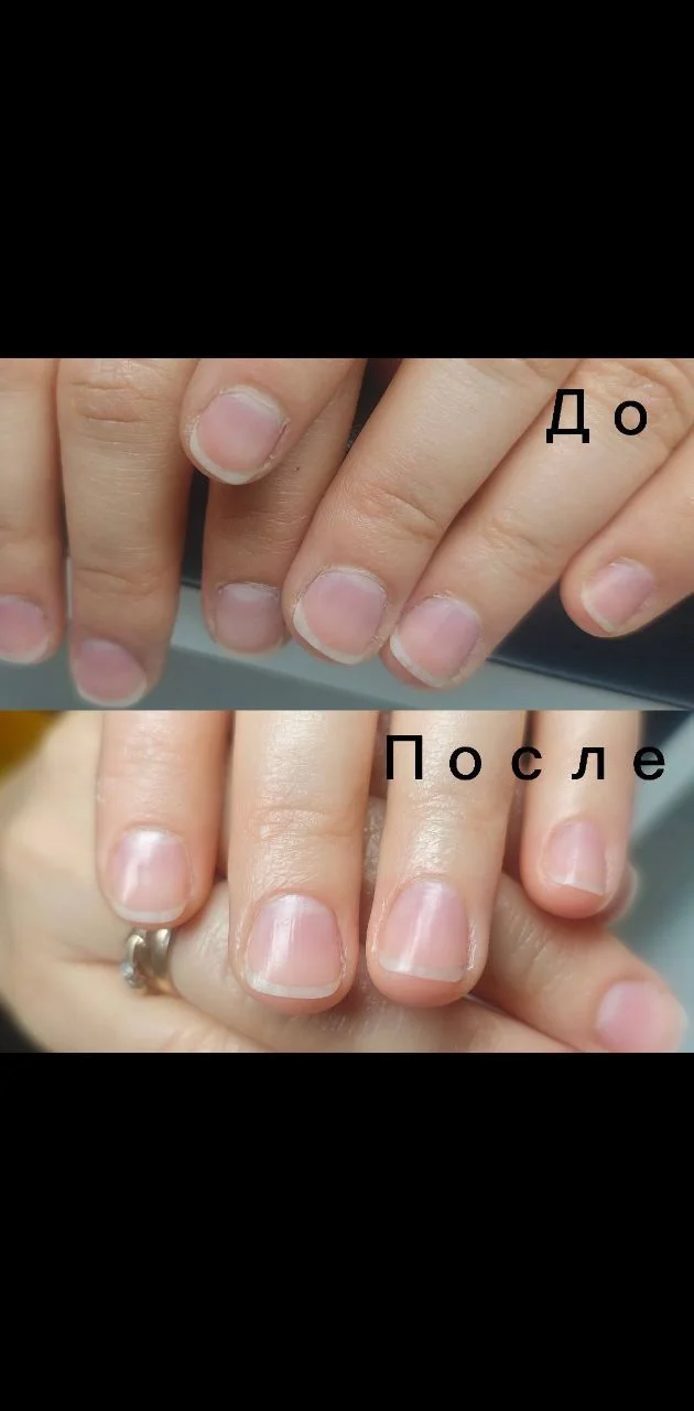 Педикюр, маникюр, подология - миниатюра 9