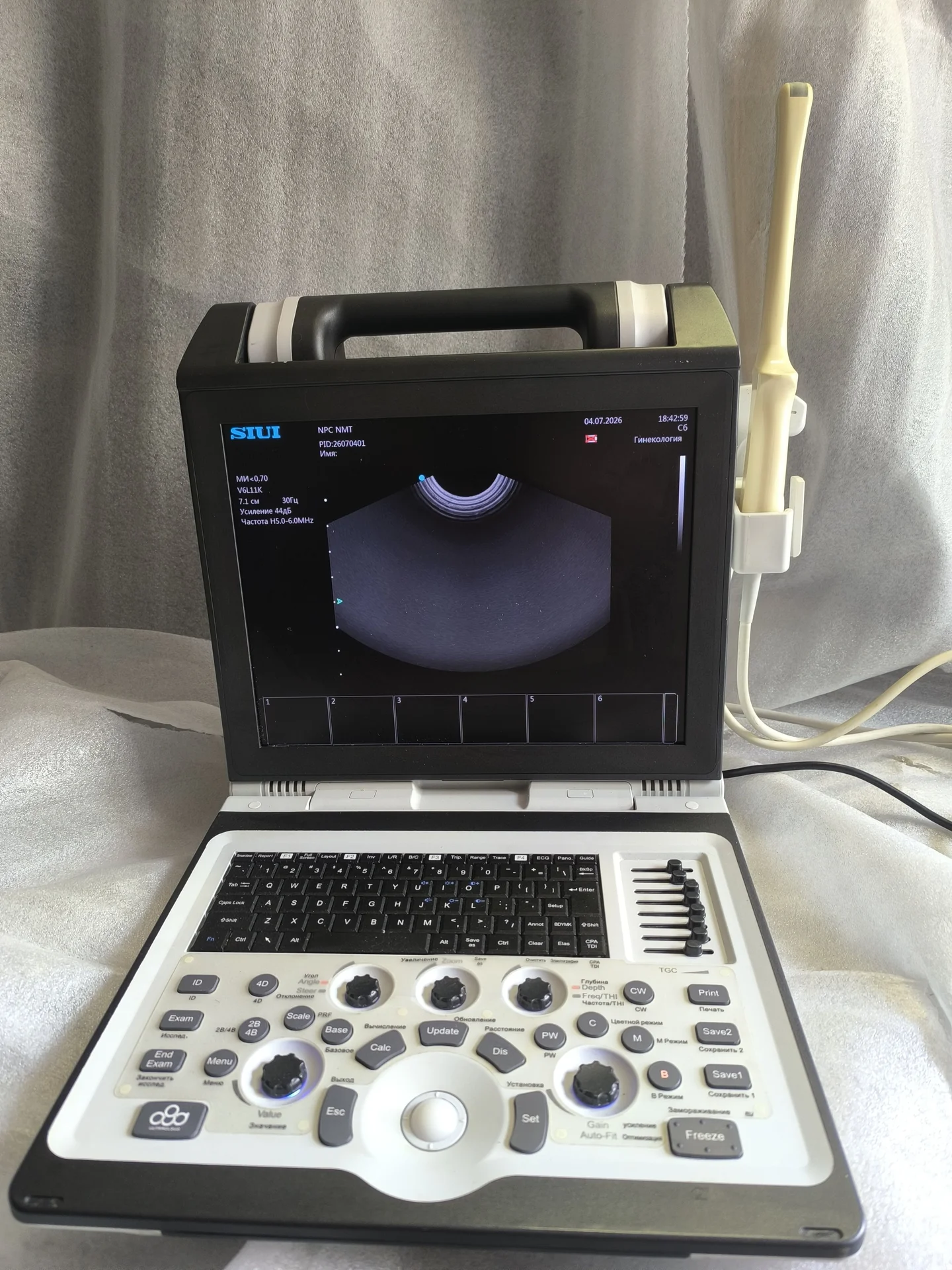 Портативный УЗИ SIUI Apogee 1100 - изображение 1