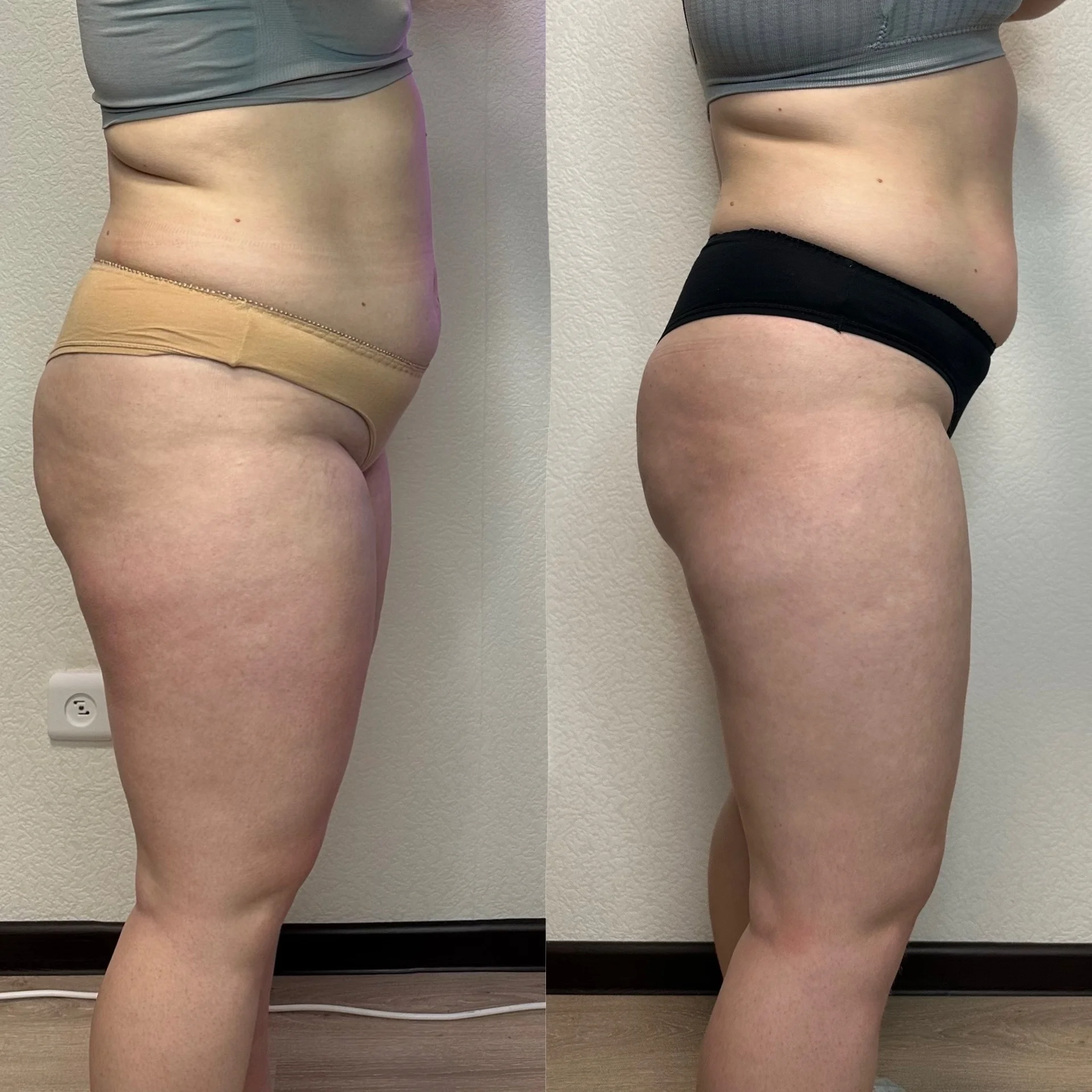 Массаж - миниатюра 6