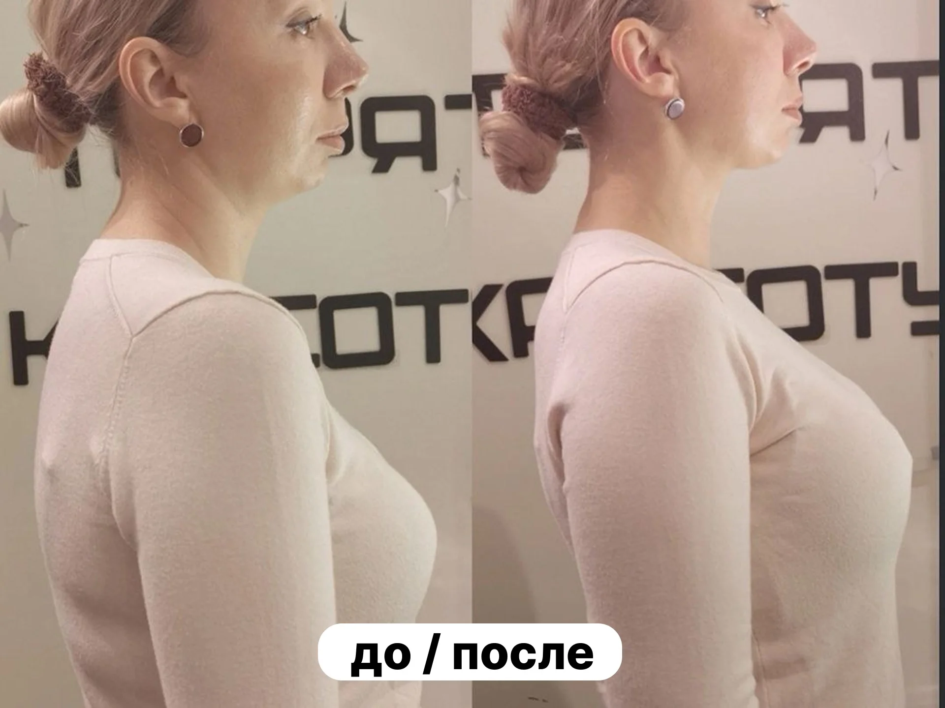 Устраняю боль в спине и сутулость за 1 сеанс - миниатюра 5