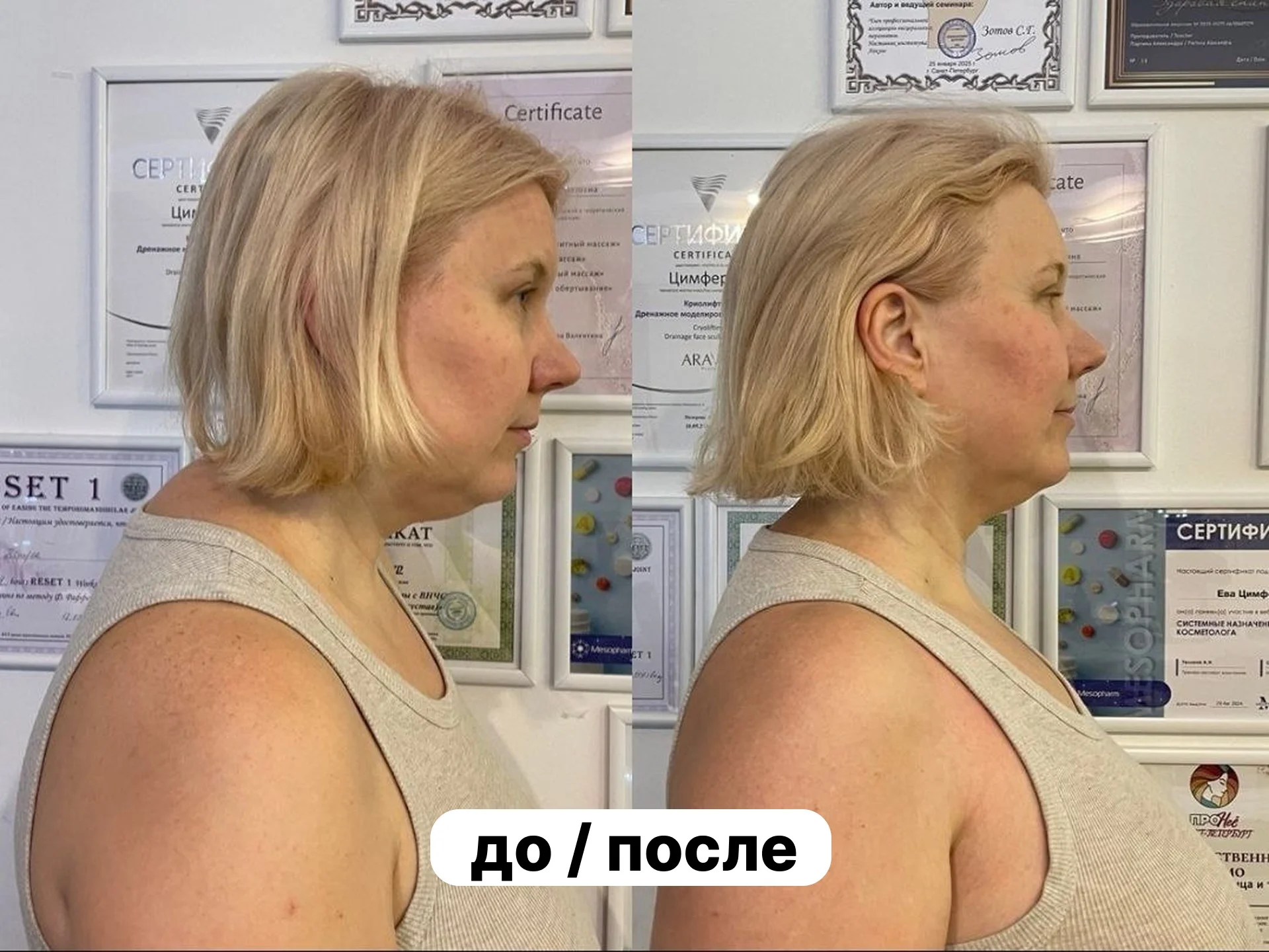 Устраняю боль в спине и сутулость за 1 сеанс - миниатюра 6