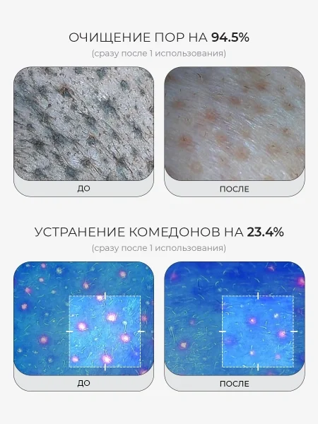 MEDICUBE Гидрофильное масло от чёрных точек - миниатюра 3