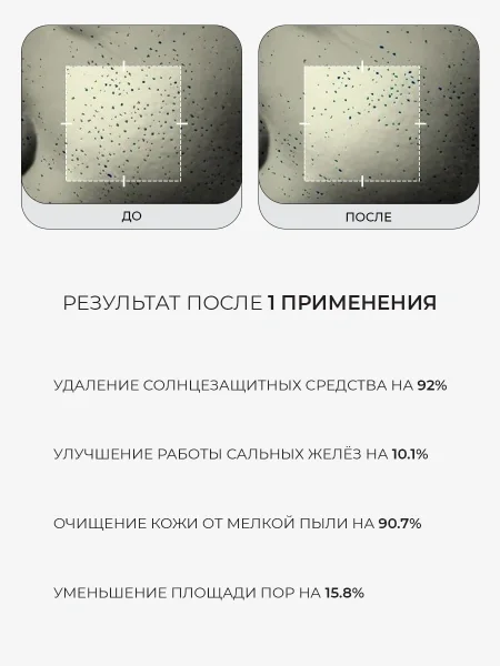 MEDICUBE Гидрофильное масло от чёрных точек - миниатюра 4