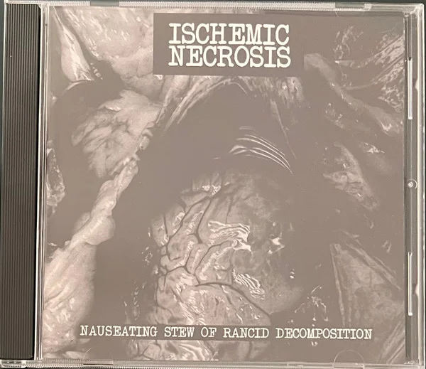 Ischemic Necrosis – Nauseating Stew Of Rancid… - изображение 1