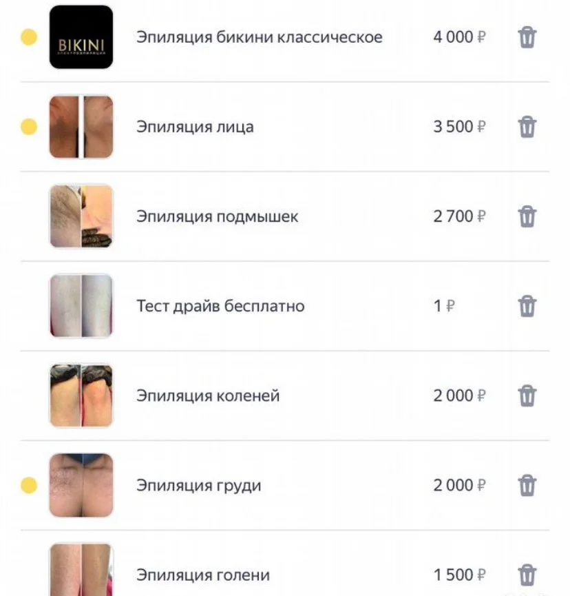 Электроэпиляция Удаление волос навсегда - миниатюра 8