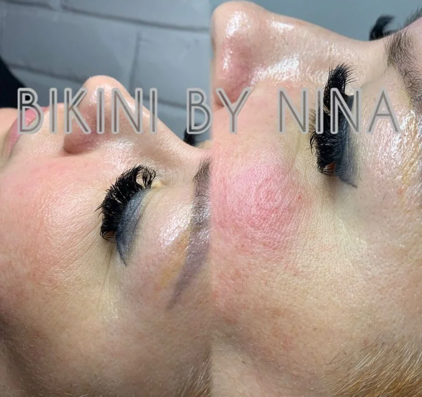 Чистка лица Пилинг HydroFacial Биоревитализация - изображение 1